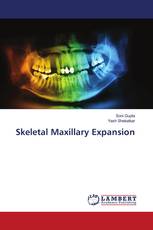Skeletal Maxillary Expansion