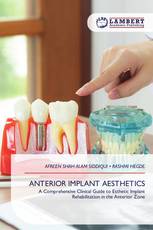 ANTERIOR IMPLANT AESTHETICS