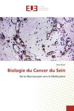 Biologie du Cancer du Sein