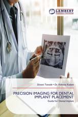 PRECISION IMAGING FOR DENTAL IMPLANT PLACEMENT
