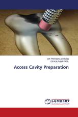 Access Cavity Preparation