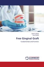 Free Gingival Graft