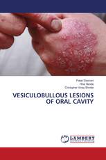 VESICULOBULLOUS LESIONS OF ORAL CAVITY
