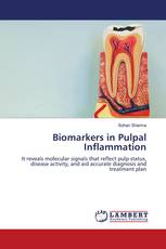 Biomarkers in Pulpal Inflammation