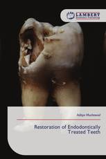 Restoration of Endodontically Treated Teeth