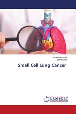 Small Cell Lung Cancer