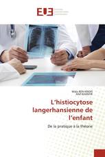 L’histiocytose langerhansienne de l’enfant