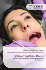 Temporary Anchorage Devices