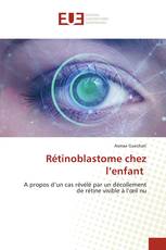 Rétinoblastome chez l’enfant