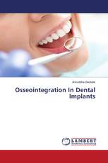 Osseointegration In Dental Implants