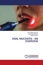 ORAL MUCOSITIS - AN OVERVIEW