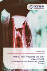 Vertical root fractures and their management