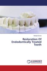 Restoration Of Endodontically Treated Tooth