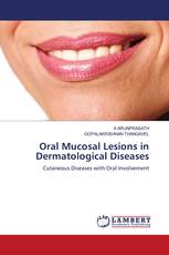 Oral Mucosal Lesions in Dermatological Diseases