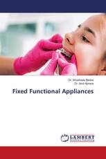 Fixed Functional Appliances