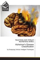 Alzheimer's Disease Classification