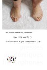 HALLUX VALGUS