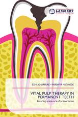 VITAL PULP THERAPY IN PERMANENT TEETH