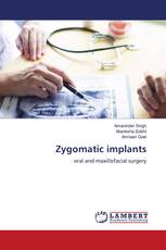 Zygomatic implants