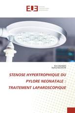 STENOSE HYPERTROPHIQUE DU PYLORE NEONATALE : TRAITEMENT LAPAROSCOPIQUE