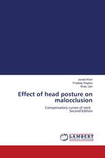 Effect of head posture on malocclusion