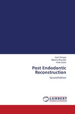 Post Endodontic Reconstruction