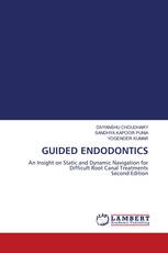 GUIDED ENDODONTICS