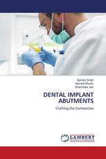 DENTAL IMPLANT ABUTMENTS