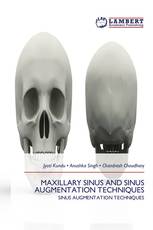 MAXILLARY SINUS AND SINUS AUGMENTATION TECHNIQUES