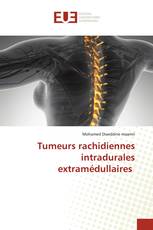 Tumeurs rachidiennes intradurales extramédullaires