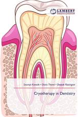 Cryotherapy in Dentistry