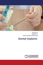 Dental implants