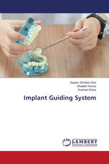 Implant Guiding System