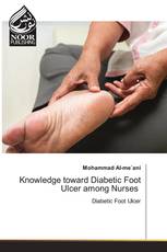 Knowledge toward Diabetic Foot Ulcer among Nurses