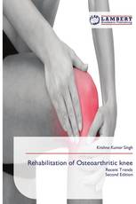 Rehabilitation of Osteoarthritic knee