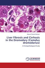 Liver Fibrosis and Cirrhosis in the Dromedary (Camelus dromedarius)