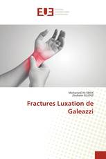 Fractures Luxation de Galeazzi