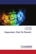 Expansion: Past To Present