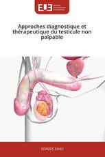 Approches diagnostique et thérapeutique du testicule non palpable