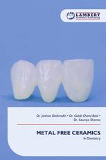 METAL FREE CERAMICS