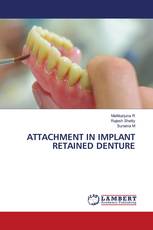 ATTACHMENT IN IMPLANT RETAINED DENTURE