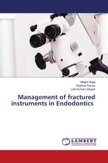 Management of fractured instruments in Endodontics