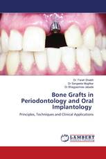 Bone Grafts in Periodontology and Oral Implantology