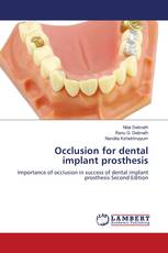 Occlusion for dental implant prosthesis
