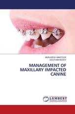 MANAGEMENT OF MAXILLARY IMPACTED CANINE