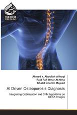 AI Driven Osteoporosis Diagnosis