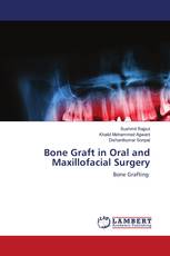 Bone Graft in Oral and Maxillofacial Surgery