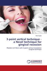3-point vertical technique - a Novel technique for gingival recession