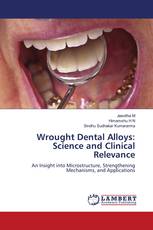 Wrought Dental Alloys: Science and Clinical Relevance