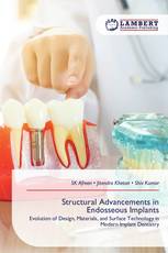Structural Advancements in Endosseous Implants